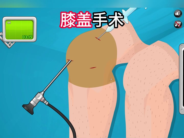 做手术小游戏下载_(脊柱手术小游戏下载)